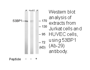Product image for 53BP1 (Ab-29) Antibody
