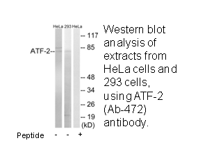 Product image for ATF-2 (Ab-472) Antibody