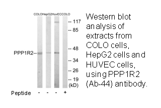 Product image for PPP1R2 (Ab-44) Antibody