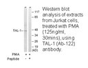 Product image for TAL-1 (Ab-122) Antibody