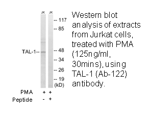 Product image for TAL-1 (Ab-122) Antibody