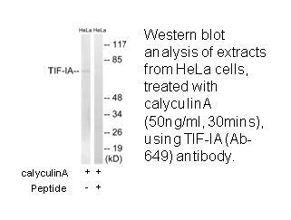 Product image for TIF-IA (Ab-649) Antibody