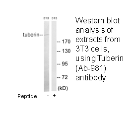 Product image for Tuberin (Ab-981) Antibody