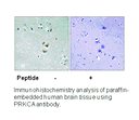 Product image for PRKCA (Ab-657) Antibody