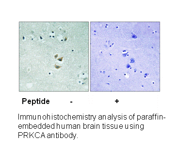 Product image for PRKCA (Ab-657) Antibody