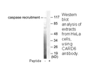 Product image for CARD6 Antibody