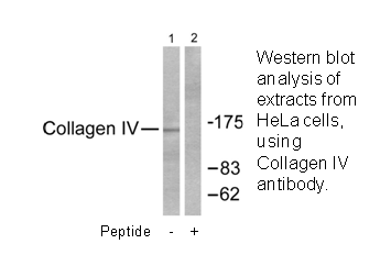 Product image for Collagen IV Antibody