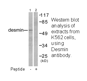 Product image for Desmin Antibody