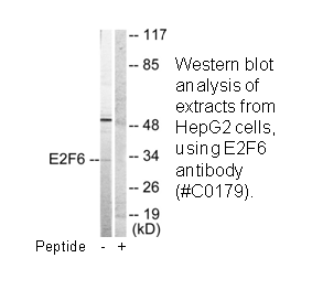 Product image for E2F6 Antibody