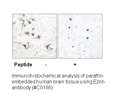 Product image for Ezrin Antibody