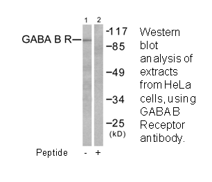Product image for GABA-B Receptor Antibody