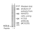 Product image for hCG &beta; Antibody