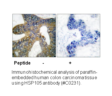 Product image for HSP105 Antibody