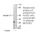 Product image for Keratin 17 Antibody