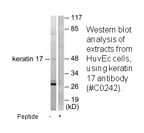 Product image for Keratin 17 Antibody