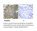 Product image for Keratin 7 Antibody