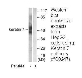 Product image for Keratin 7 Antibody