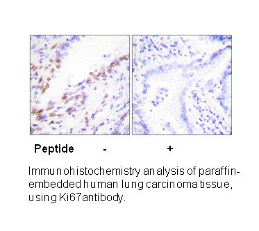 Product image for Ki67 Antibody
