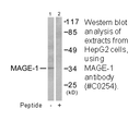 Product image for MAGE-1 Antibody