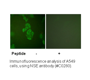Product image for NSE Antibody
