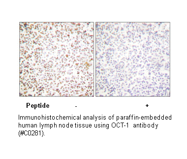 Product image for OCT1 Antibody