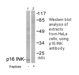 Product image for p16 INK Antibody