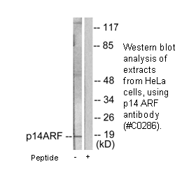 Product image for p14 ARF Antibody