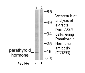 Product image for Parathyroid Hormone Antibody