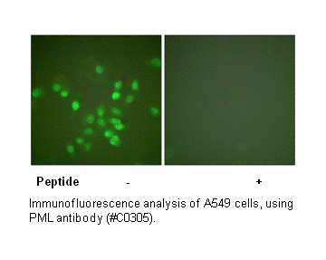Product image for PML Antibody