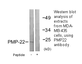 Product image for PMP22 Antibody