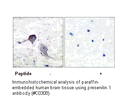Product image for Presenilin 1 Antibody