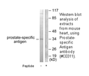 Product image for Prostate-specific Antigen Antibody