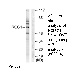 Product image for RCBTB1 Antibody