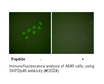 Product image for SKP2/p45 Antibody