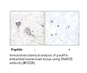 Product image for SNAP25 Antibody