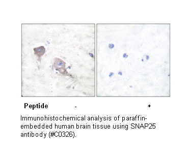 Product image for SNAP25 Antibody