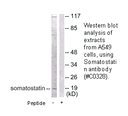 Product image for Somatostatin Antibody