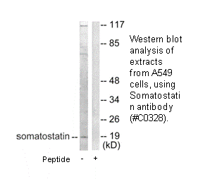 Product image for Somatostatin Antibody