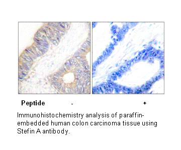 Product image for Stefin A Antibody