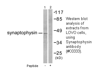 Product image for Synaptophysin Antibody