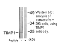 Product image for TIMP1 Antibody