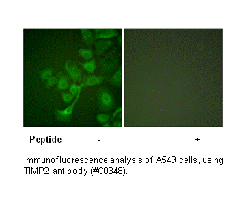 Product image for TIMP2 Antibody