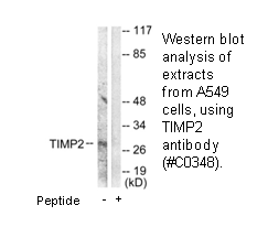 Product image for TIMP2 Antibody