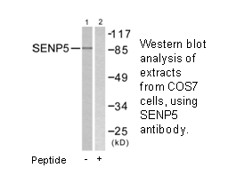Product image for SENP5 Antibody