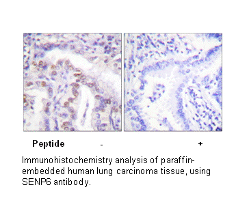 Product image for SENP6 Antibody