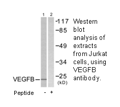 Product image for VEGFB Antibody