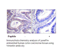 Product image for Vimentin Antibody