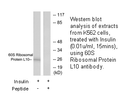Product image for 60S Ribosomal Protein L10 Antibody