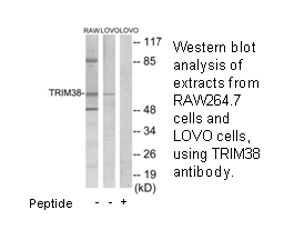 Product image for TRIM38 Antibody