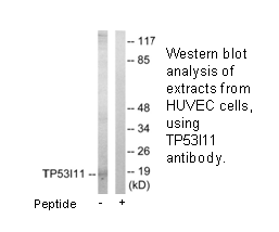 Product image for TP53I11 Antibody